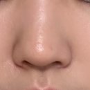 하이포레버 이미지