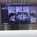 두리치과의원 | 백 추 일 마지막 !