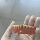 네이치과기공소 이미지