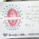 [육아] 치과 영유아검진 후기 운정어린이치과 주니어스 벌써 충치