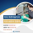 아로치과의원 | 미니쉬치과가격 비용 단점&lt;보존과 전문의가 밝힙니다&gt;