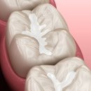 진 치과 기공소 이미지