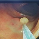 삼성보스톤내과의원 | 종로 내과 추천!! 내시경센터! (삼성보스톤내과의원 솔직후기 감동후기)