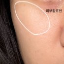 풀리토케어