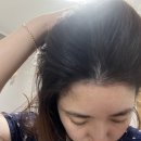 로즈마리 헤어 두피 토닉으로 두피케어 사용후기