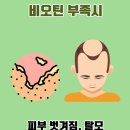 탈모 관리 영양제 선택 기준 및 추천