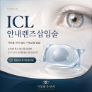 인천 논현동안과 ICL 안내렌즈삽입술 대상 렌즈 종류 비용 및 주의사항 ft. 부작용