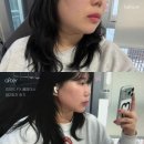 연한풀피부과의원 | 연신내역 피부과 | 인모드FX 풀페이스 리프팅 2회차 솔직후기