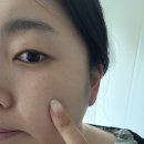금새약국 | 남포동피부과 부산피코·제네시스·셀렉 3종 후기 + 남포동약국 공휴일약국에서 텐텐 득템까지!