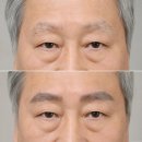 눈썹디자인