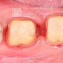 누가치과기공소 이미지