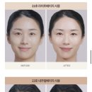 초이스인셀덤