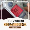 지샘병원급 의료기관 | 군포지샘병원 소아병동 입원 후기｜메타뉴모바이러스 폐렴, 아기 고열과 기침 대처법 (육아 필수 정보)