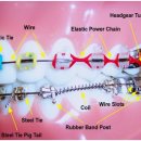 스마트원치과병원 | 부평역치과 교정, 300만 원 vs 800만 원? 병원마다 가격 차이 나는 이유 (비용, 성인, 어린이)