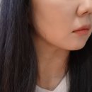 부산 올타이트리프팅 400샷 후기 | 다운타임없는 사직 착붙리프팅 대만족 리뷰