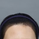 헤어에이드 이미지
