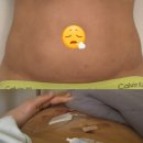 더클래식산부인과의원 | 난소낭종 수술 후기(1편)