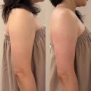 비송에스테틱 | 압구정피부관리 루온에스테틱, 얼음과 불의 노래 같은 티리온-x여