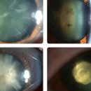 아이아이안경콘텍트 이미지