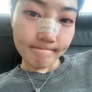 계단에 코 박고 산재처리 알아보는 사람의 일기