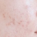 아젤리아 이미지