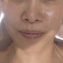 [마산피부관리] 자극 없이 효과 좋은 맞춤피부관리, 난다뷰티 텔로미어 부스터 후기
