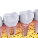 서울에스(S)클래스치과의원 이미지