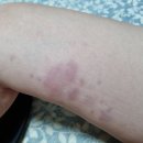 💃🏻 폴댄스 입문 후기: 첫 수업부터 근육통까지 솔직 리뷰