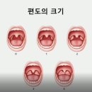 소리숨이비인후과건강 네이버블로그