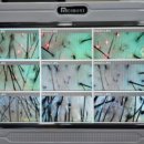 그로우모모 두피 탈모 케어센터 이미지