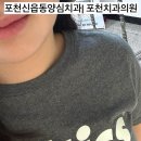 신읍동 포천치과의원 양심치과 추천! 충치치료 재방문