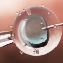 아이두헬스케어 이미지