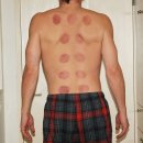 송강한의원 이미지