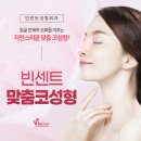 빈센트성형외과 네이버블로그
