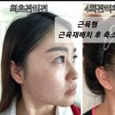 뷰티라인 이미지