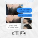 흥미헤어라인 | 양산두피문신 헤어라인 후기