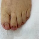 레푸스진주대안점