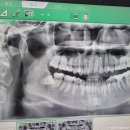 불꽃치과의원 이미지