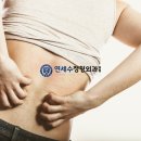 세교정형외과의원 네이버블로그