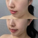 진주신부관리 차크란에스테틱 예비신부 추천 후기