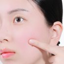 (주)엔피씨 | 장벽크림 환절기 보습 관리! 민감 피부 메디솝 B5크림 후기