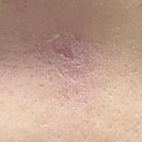 서호약국 | 고함량 덱스 판테놀 앰플 추천 싱그리디언트 티트리 진정 고보습 대용량 앰플 후기