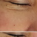 오로라 뷰티 이미지