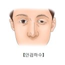 안검하수[Ptosis of eyelid눈질환] 이미지