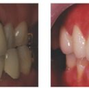 제이치과기공소 이미지