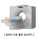 외상성 경막하 출혈[Traumatic subdural hemorrhage] 이미지
