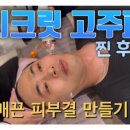 고주파 | 시크릿 고주파 리얼 후기 효과