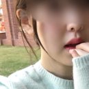 브이의원 | 브이의원 강남점 울쎄라 300샷 후기｜심부볼·팔자 개선🧑🏻‍⚕️✨