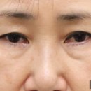 리미트성형외과의원