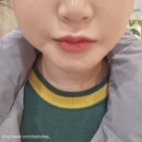 케이톡스의원 인천구월점 | [인천 구월동] 입술필러 입꼬리 필러 내돈내산 솔직 후기 :: 케이톡스 인천구월점